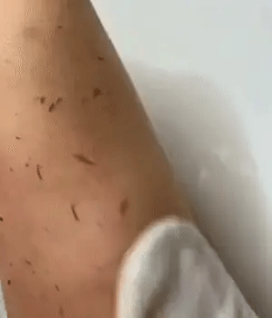 Gant Exfoliant prenium Novaa®