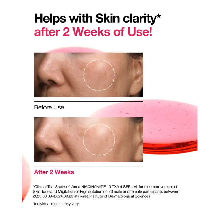 Anua Sérum Anti-Taches Niacinamide 10 % + TXA 4 % : Éclat & Correction – 30 ml - Novaa skin care