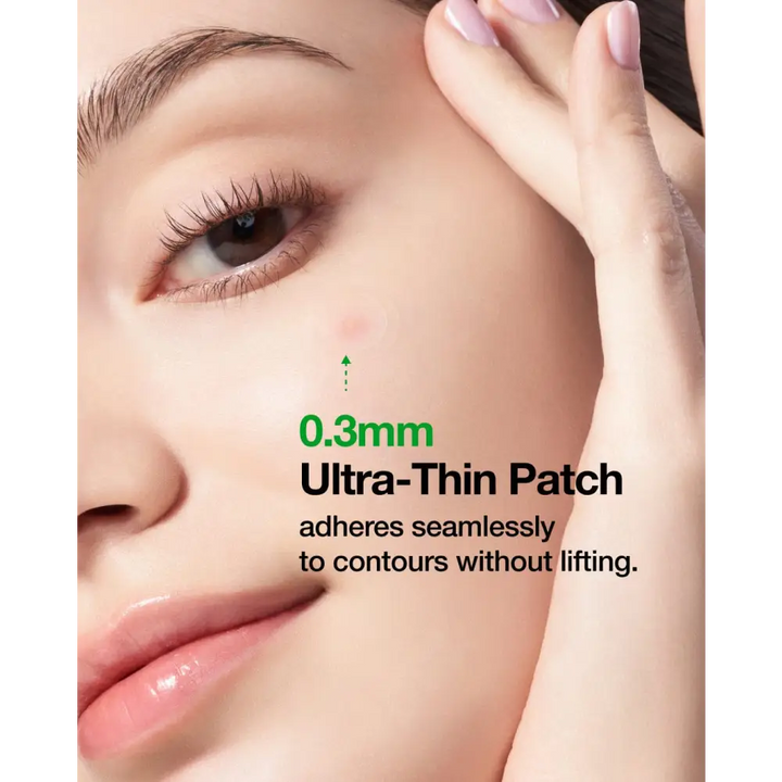 Anua Triple Acid Spot Care Microdart Patch: AHA, BHA & PHA - 12 pcs - Novaa skin care
