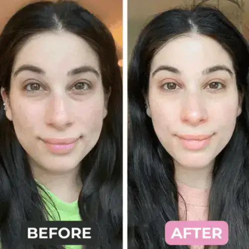 Appareil Anti-Cernes et Anti-Poches à Microcourant