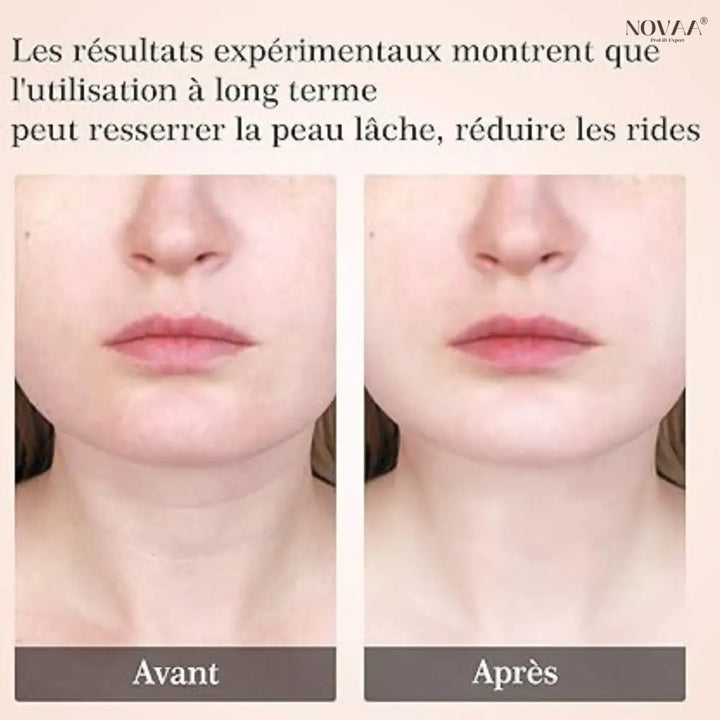Appareil de Massage du Cou - Anti-Rides 3 Modes USB | Novaa® Pro Lift Expert