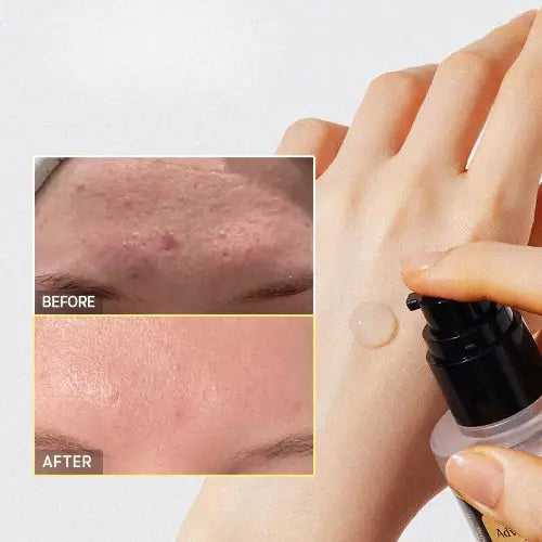COSRX - Essence avancée de puissance de mucine 96 d’escargot - 100mL - Novaa skin care