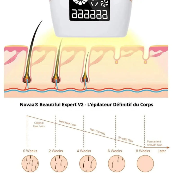 Épilateur des poils IPL Dernière Génération pour Corps | Novaa® Beautiful Expert V2