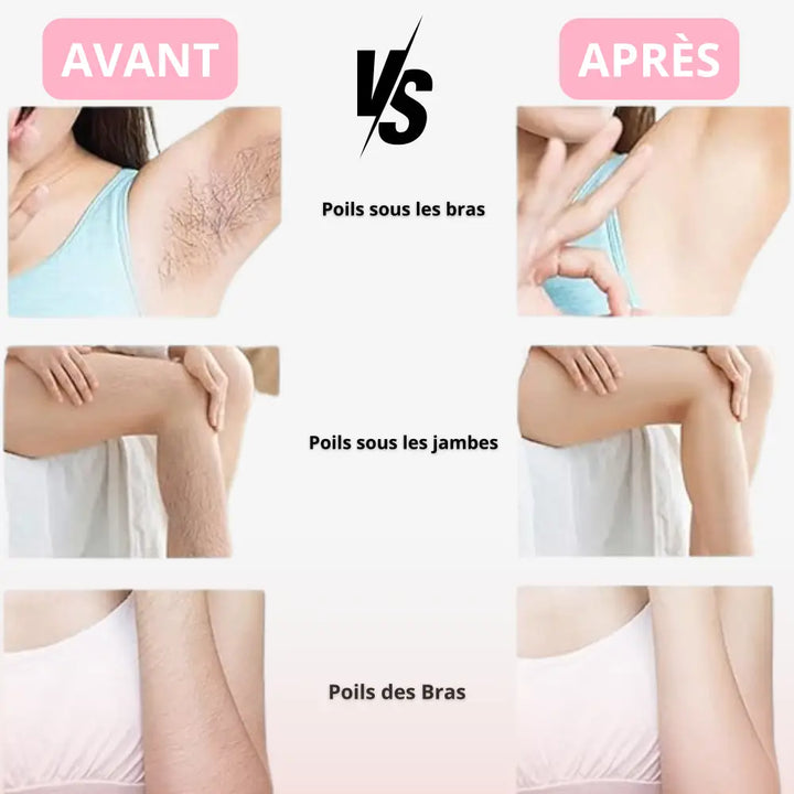 Gomme épilatoire réutilisable Novaa®Lisse