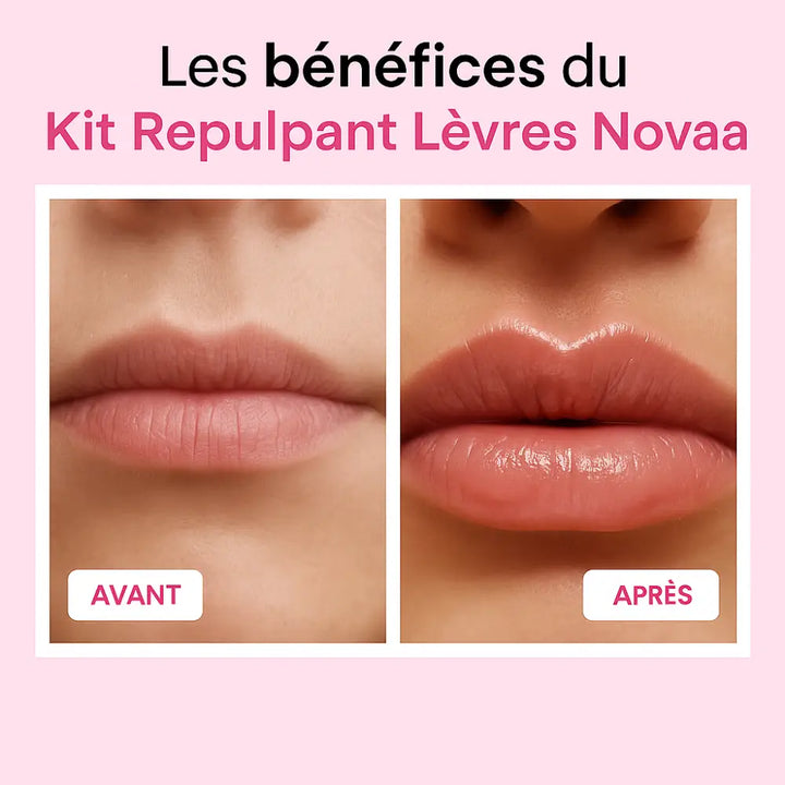 Kit Repulpant Lèvres Novaa® – Lip Boost Naturel - Novaa skin care