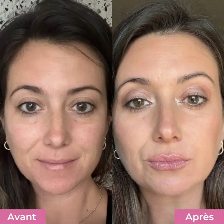 Kit Repulpant Lèvres Novaa® – Lip Boost Naturel - Novaa skin care