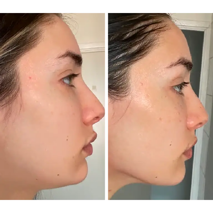 Sculpteur Facial Anti-Rides | Novaa® Pro Lift Expert - Novaa Produit test
